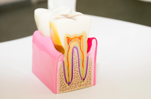 保険治療の根管治療の成功率は30