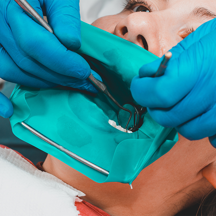 ラバーダム防湿｜福岡県西区のないとうファミリー歯科クリニック